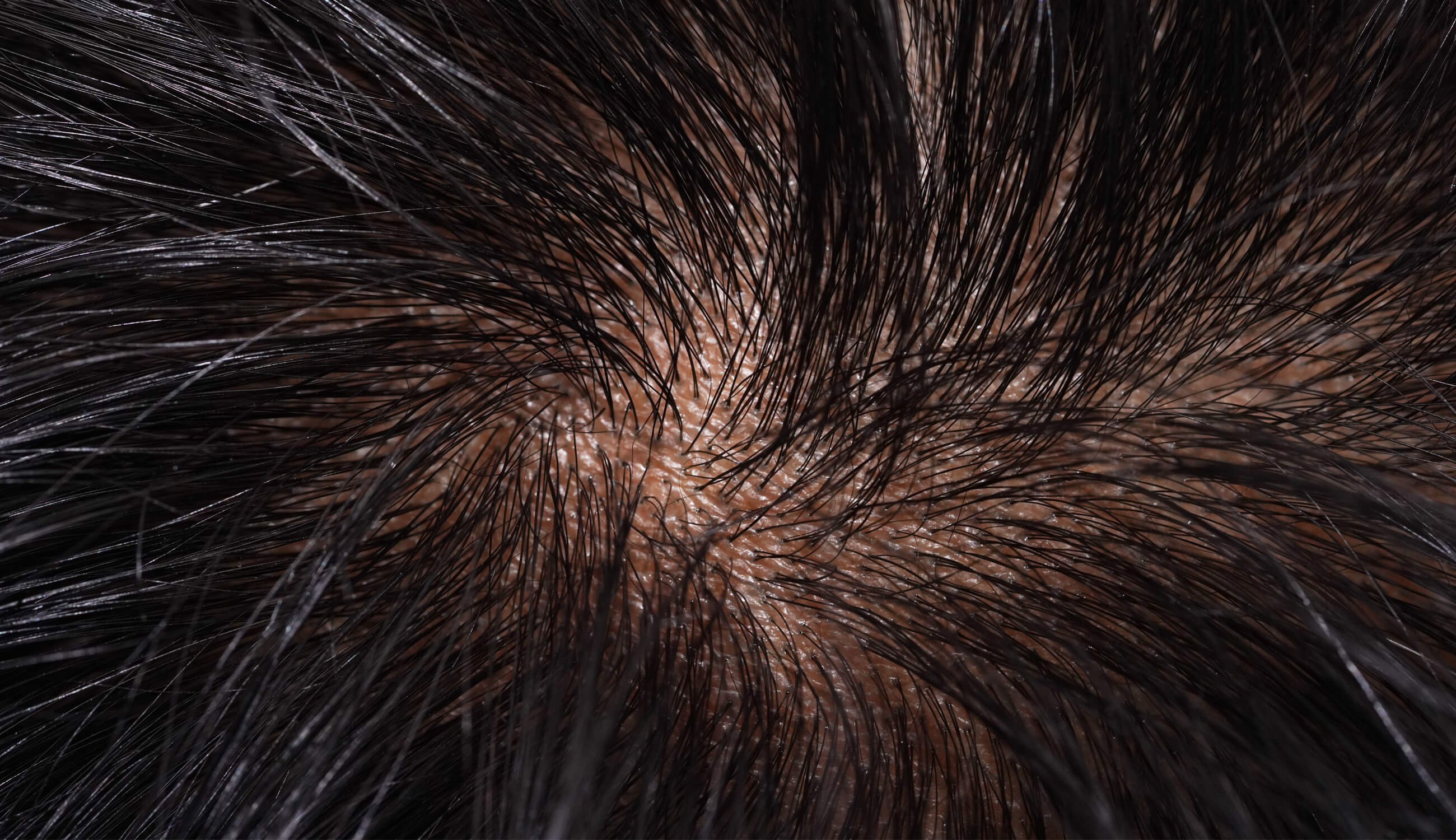 Close up of hair scalp