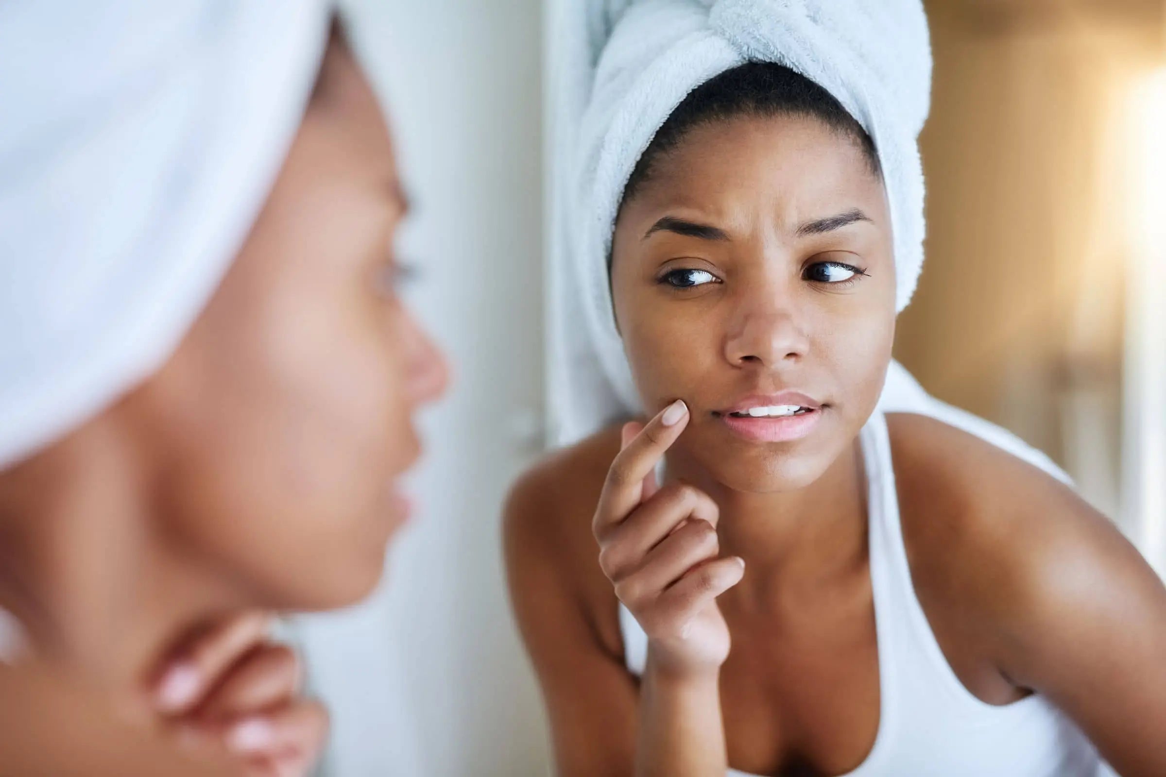 Summer Breakouts Can Happen—Here's How to Treat and Prevent Them